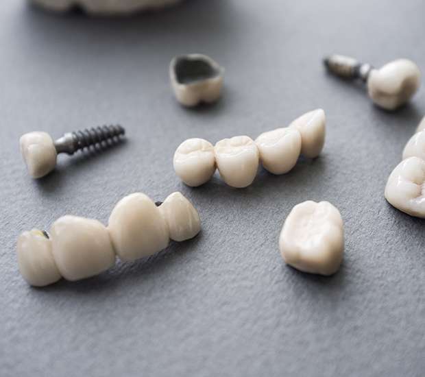Portsmouth The Difference Between Dental Implants and Mini Dental Implants